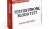 Testosterone Blood Test: Key Facts for Wolverhampton Locals